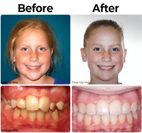 mcallen orthodontic group